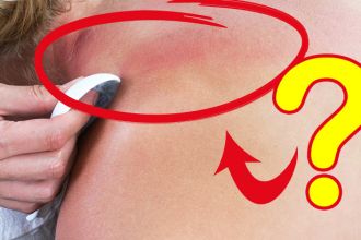 Gua Sha Scraping