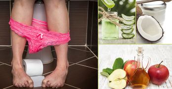 How to treat anal fissues naturally