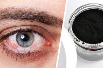 How to use activated charcoal for pink eye