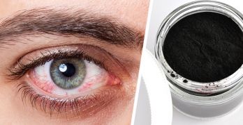 How to use activated charcoal for pink eye