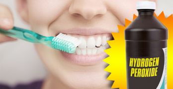 Hydrogen peroxide for teeth whitening, hair and more