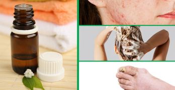 Tea tree oil benefits and how to use it