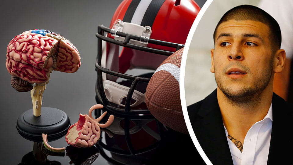 Autopsy Finds NFL Murderer Aaron Hernandez Had Severe Case of 'CTE'