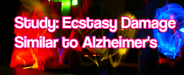 Study: Ecstasy Damage Similar to Alzheimer's