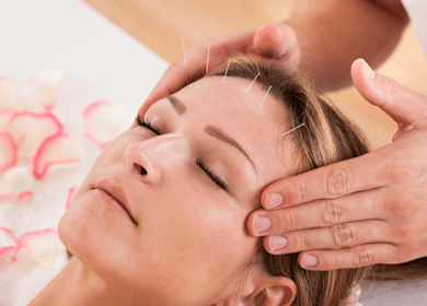 How Acupuncture Helps Migraines How Acupuncture Helps Migraines