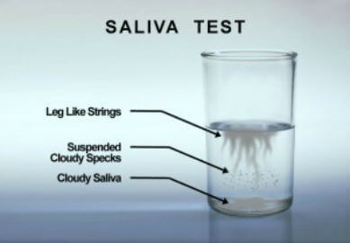 Yeast infection from saliva