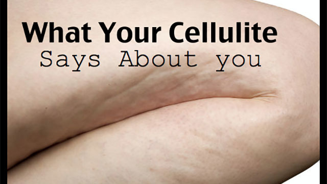 cellulite and health