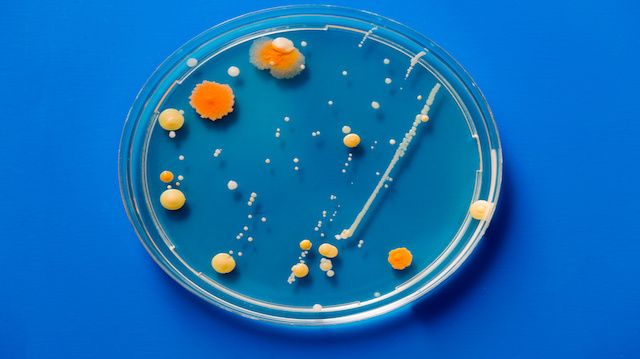 Bacteria colonies on petri dishes on blue