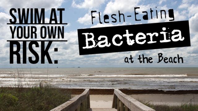flesheatingbacteria_730x410 (1)