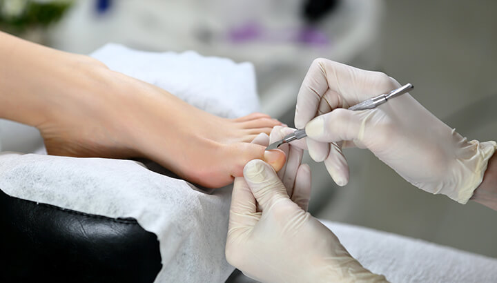 Ingrown toenail remedies cut cuticles