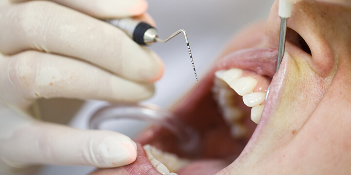 Poor oral health and periodontitis is linked to heart disease.