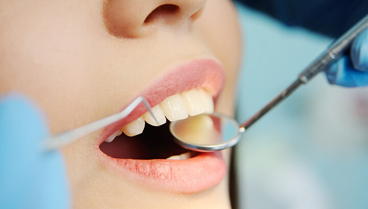 Oil pulling can whiten your teeth naturally.