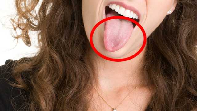 What your tongue says about your health