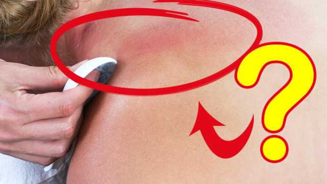 Gua Sha Scraping