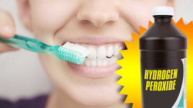 Hydrogen Peroxide For Teeth Whitening Hair And More