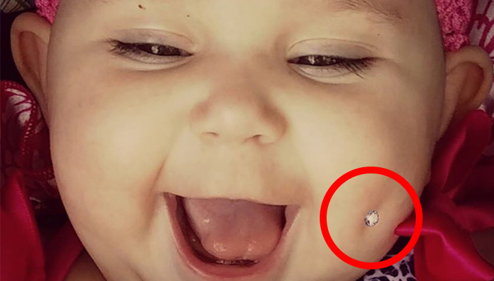 Picture Of Baby With Pierced Dimple Sparks Outrage