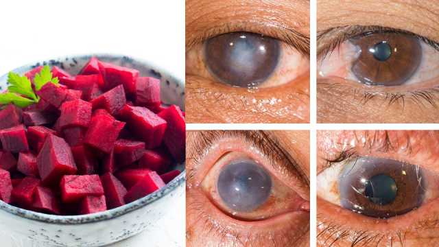superfoodsvision_featured_960x540