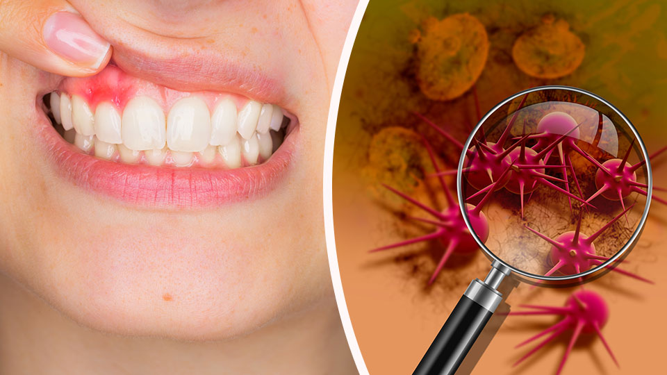 Here's How To Know If You Have Inflammation In Your Mouth