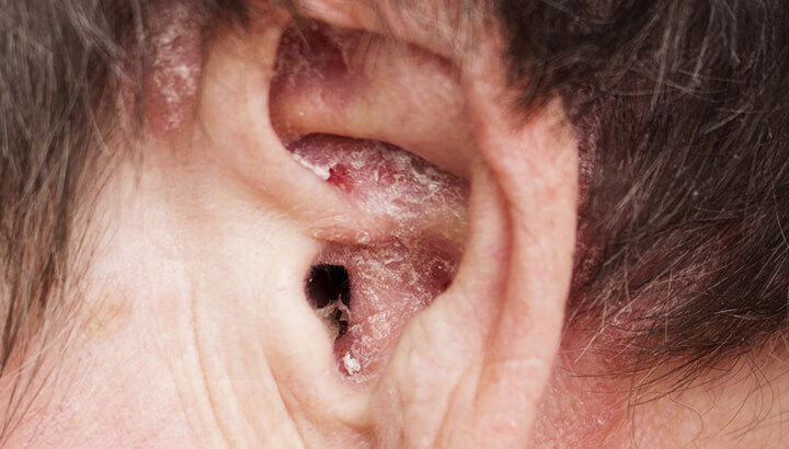 5 Things Your Earwax Says About Your Health