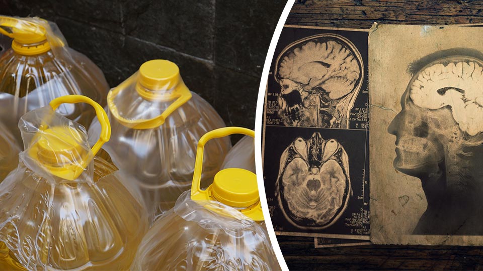 Canola Oil Might Be Bad For Your Memory Study Finds