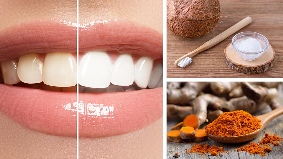 Whiten Your Teeth With These Turmeric And Coconut Oil Cubes