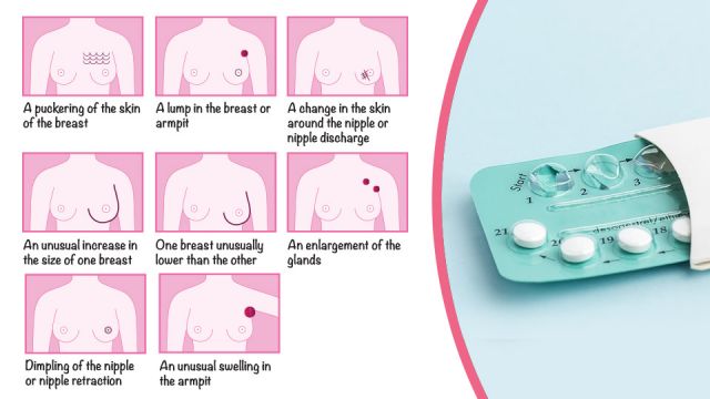 breast birth control cancer risk increase could re views