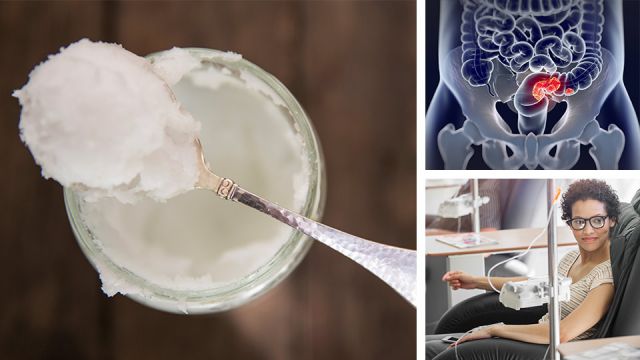 3amazingbenefitsofcoconutoilforcancerpatients_featured_960x540