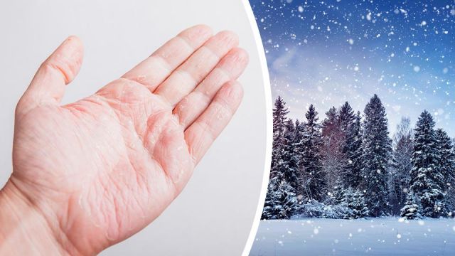 If You Have Dry Hands During Winter Try This Overnight Trick