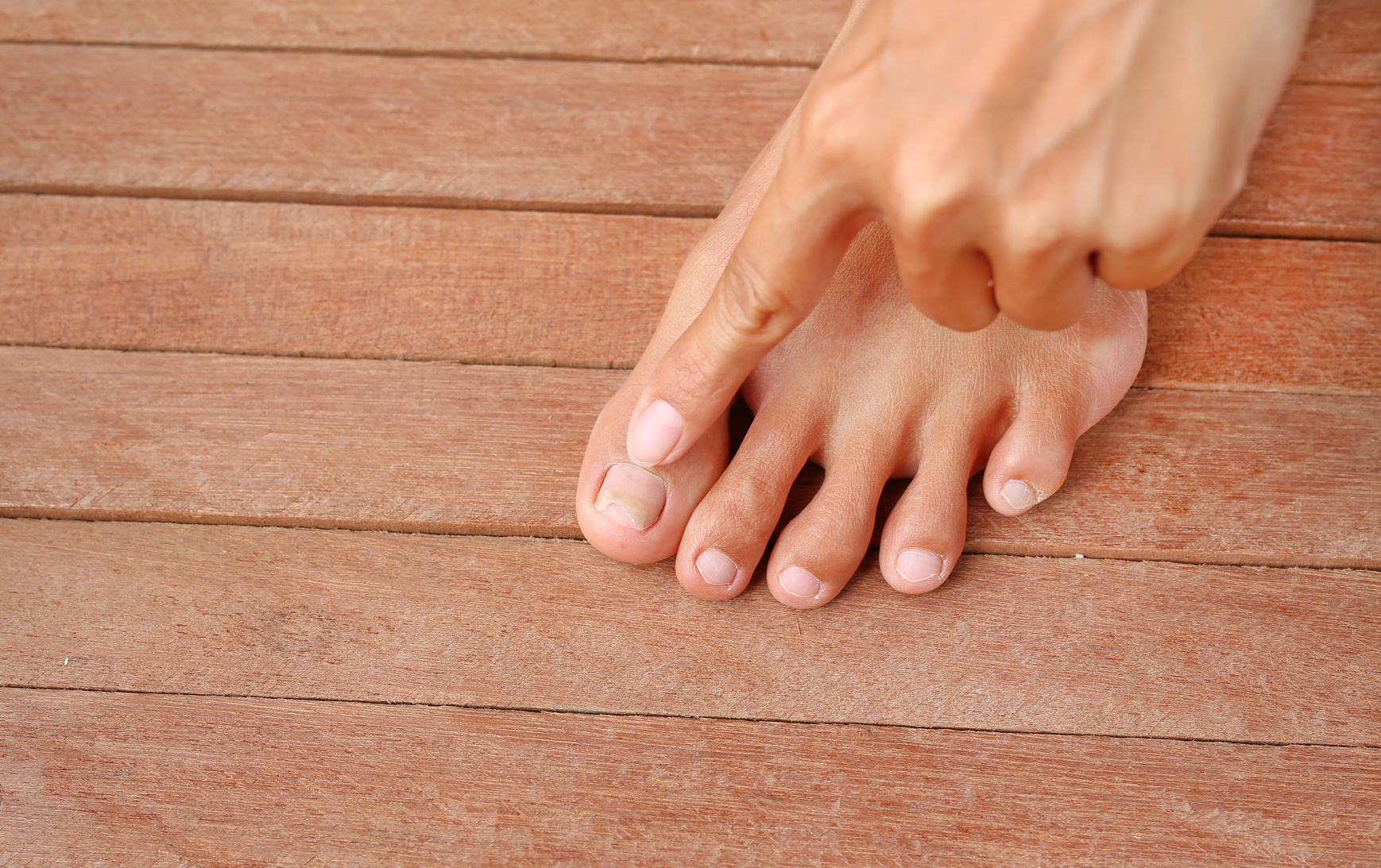 9-things-your-feet-are-trying-to-tell-you-about-your-health