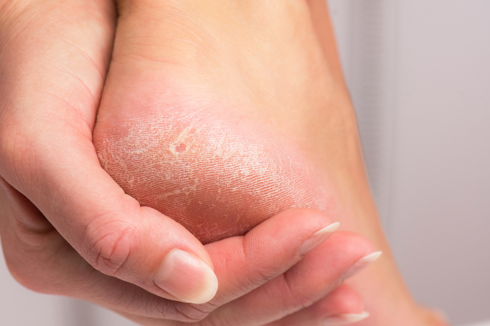 9-things-your-feet-are-trying-to-tell-you-about-your-health