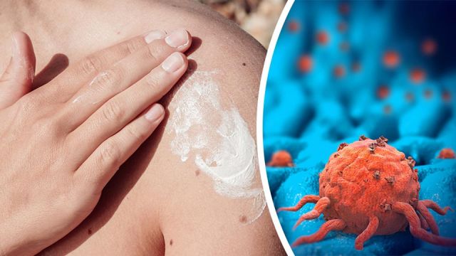 isyoursunscreenincreasingyourriskforskincancer_featured_960x540