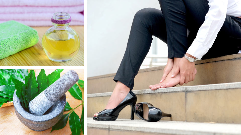 5 Natural Remedies For Cracked Heels (2 Is SHOCKING!)