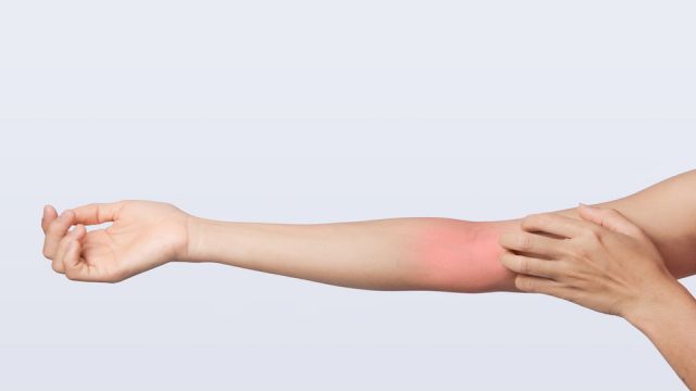 left hand scratching right arm around elbow joint