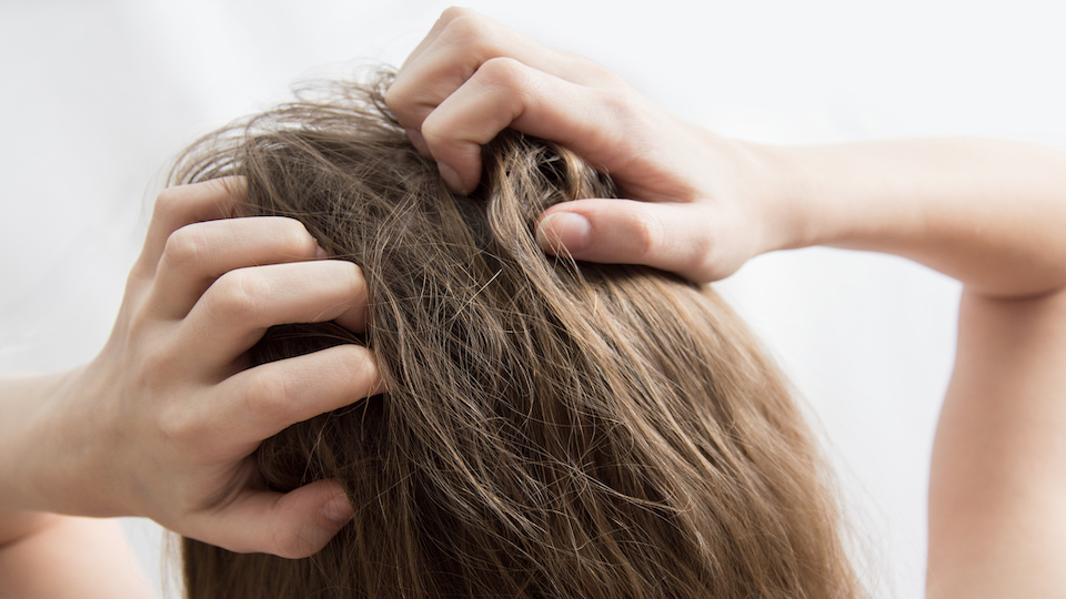 here-s-how-to-fix-an-itchy-scalp-once-and-for-all