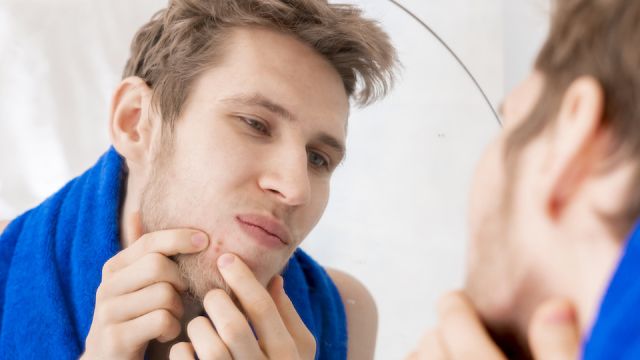 young man pushing out pimple in the bathroom, acne problem