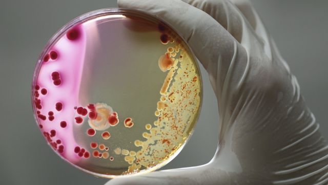 bacteria