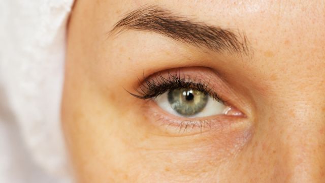 wrinkles under the eyes